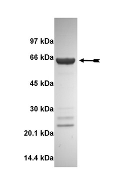 Eurofins DiscoverX DAPK2 Protein, Active 10 &mu;g | Buy Online | Eurofins DiscoverX | Fisher Scientific